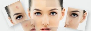 Проблемы с кожей лица, как их решить.